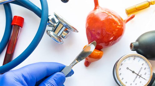 prosterafit prostatitis kronis
